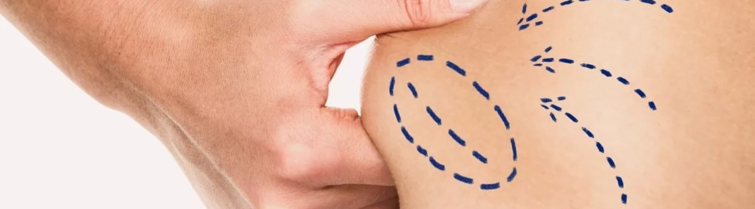 LiposuctionSurgeryClinic